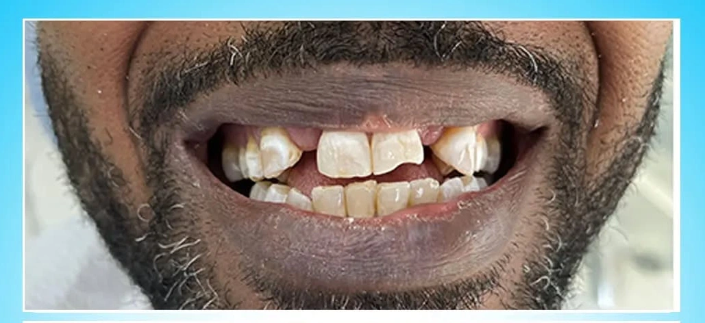 AvrupaDİŞ Ağız ve Diş Sağlığı Merkezi